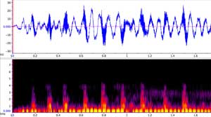 sonogram