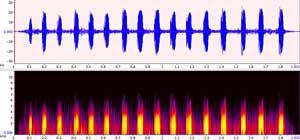 sonogram