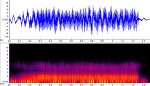 sonogram