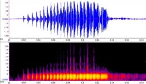 sonogram