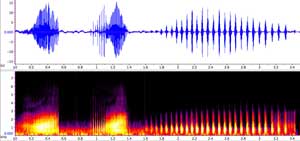 sonogram