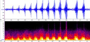 sonogram