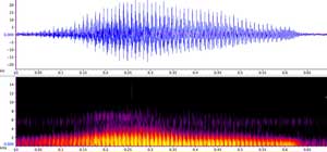 sonogram