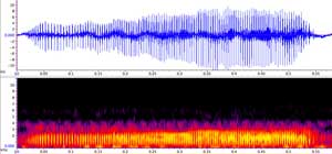 sonogram