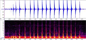 sonogram