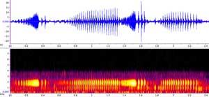 sonogram